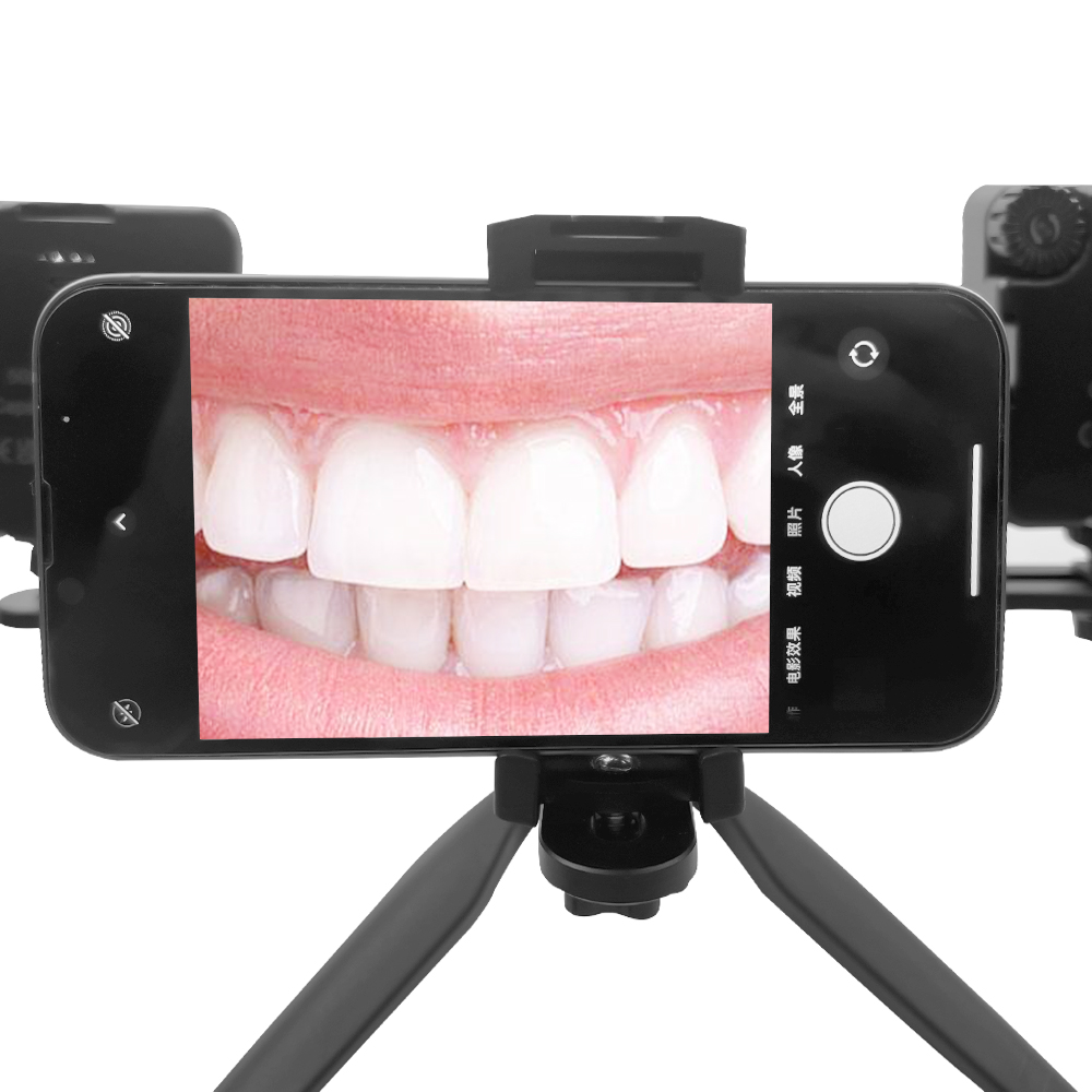 Tandheelkundige Fotografie Lic - Photography Lighting Lamp recensie en prijs